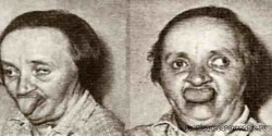 Укол
